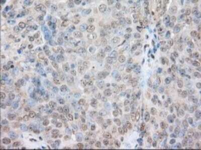 Immunohistochemistry: SH3PX1 Antibody (OTI1B5) - Azide and BSA Free [NBP2-74158]