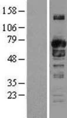 Western Blot: SH3PX1 Overexpression Lysate [NBL1-16323]