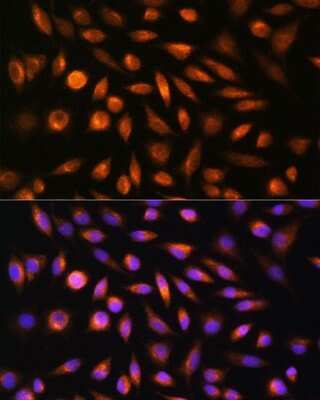 Immunocytochemistry/ Immunofluorescence: SH3PXD2A Antibody - Azide and BSA Free [NBP3-16808]