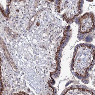 Immunohistochemistry-Paraffin: SH3PXD2A Antibody [NBP1-90455]