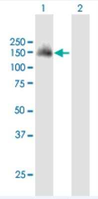 Western Blot: SH3PXD2A Antibody [H00009644-B01P-50ug]