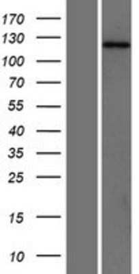 Western Blot: SH3PXD2A Overexpression Lysate [NBP2-07302]