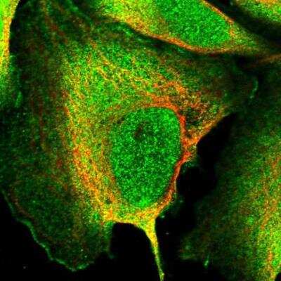 Immunocytochemistry/ Immunofluorescence: SH3PXD2B Antibody [NBP1-93965]