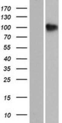 Western Blot: SH3PXD2B Overexpression Lysate [NBP2-08598]