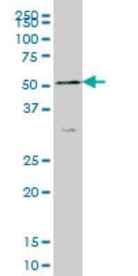 Western Blot: SH3RF2 Antibody (4E10) [H00153769-M01]