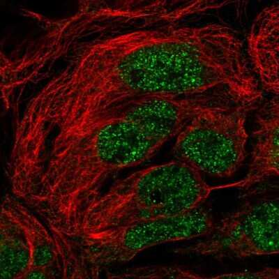 Immunocytochemistry/ Immunofluorescence: SH3RF2 Antibody [NBP2-38841]