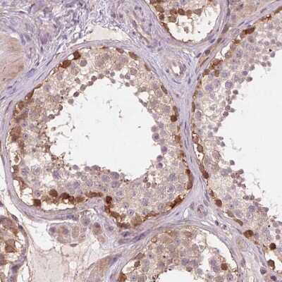 Immunohistochemistry-Paraffin: SH3RF2 Antibody [NBP2-38841]
