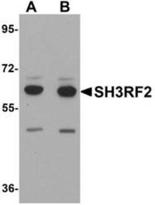 Western Blot: SH3RF2 AntibodyBSA Free [NBP1-76284]