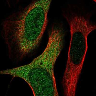 Immunocytochemistry/ Immunofluorescence: SH3TC2 Antibody [NBP2-38360]