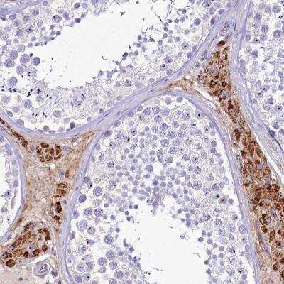 Immunohistochemistry-Paraffin: SH3TC2 Antibody [NBP1-90624]