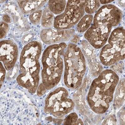 Immunohistochemistry-Paraffin: SH3YL1 Antibody [NBP1-84133]