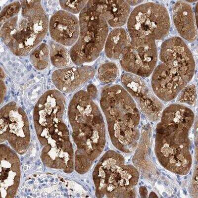 Immunohistochemistry-Paraffin: SH3YL1 Antibody [NBP1-84134]