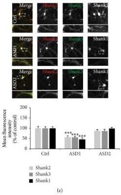 Immunocytochemistry/ Immunofluorescence: SHANK1 Antibody - BSA Free [NB300-167]
