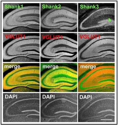 Immunohistochemistry: SHANK1 Antibody - BSA Free [NB300-167]