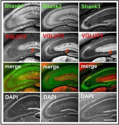 Immunohistochemistry: SHANK1 Antibody - BSA Free [NB300-167]