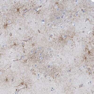 Immunohistochemistry-Paraffin: SHANK1 Antibody [NBP1-87016]