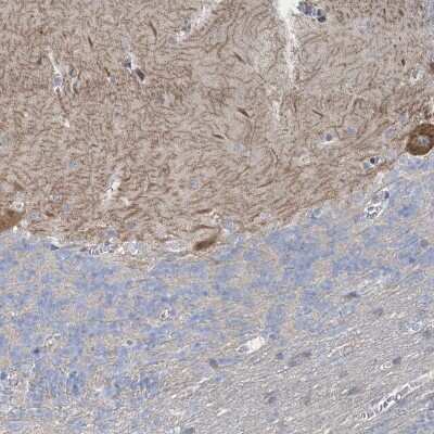 Immunohistochemistry-Paraffin: SHANK1 Antibody [NBP2-33971]