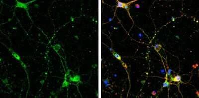 Immunocytochemistry/ Immunofluorescence: SHANK3 Antibody [NBP3-13162]