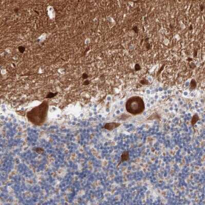 Immunohistochemistry-Paraffin: SHANK3 Antibody [NBP1-82900]