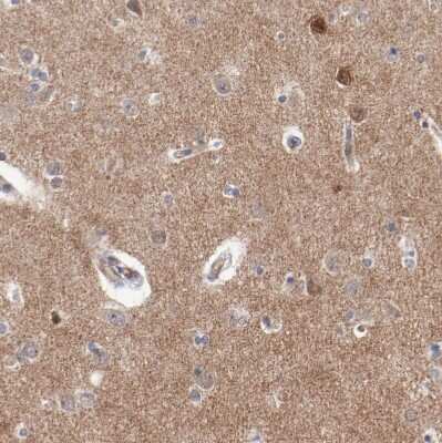 Immunohistochemistry-Paraffin: SHANK3 Antibody [NBP1-82900]