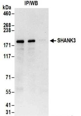 Immunoprecipitation: SHANK3 Antibody [NBP2-32161]