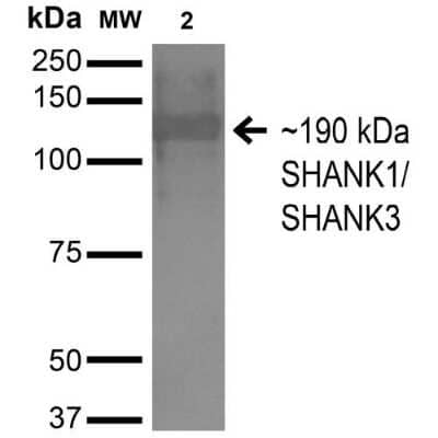 Western Blot: SHANK3 Antibody (S367-51) [NBP2-42189]