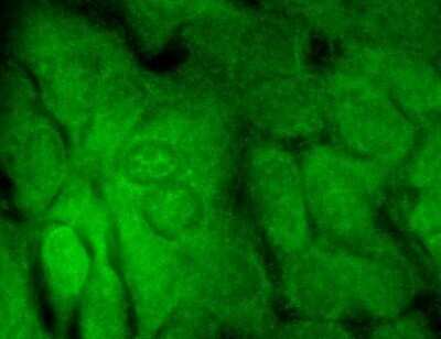 Immunocytochemistry/ Immunofluorescence: SHANK3 Antibody (S69) [NBP1-47610]