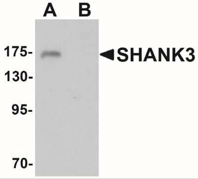 Western Blot: SHANK3 AntibodyBSA Free [NBP2-41171]