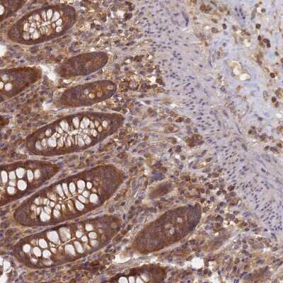 Immunohistochemistry-Paraffin: SHARPIN Antibody [NBP1-92386]