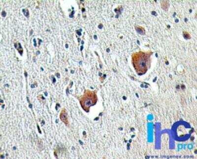 Immunohistochemistry-Paraffin: SHARPIN Antibody [NBP2-27186]