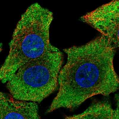 Immunocytochemistry/ Immunofluorescence: SHB Antibody [NBP2-58223]