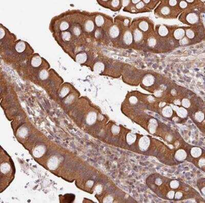 Immunohistochemistry: SHB Antibody [NBP2-30557]