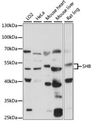 Western Blot: SHB AntibodyAzide and BSA Free [NBP2-94662]