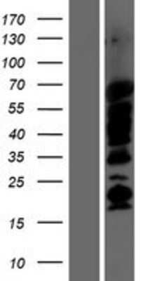 Western Blot: SHB Overexpression Lysate [NBP2-08047]