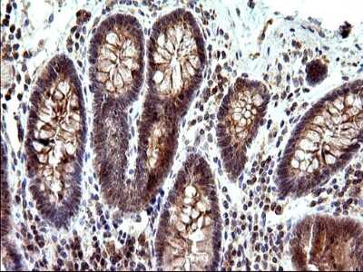 Immunohistochemistry: SHBG Antibody (OTI1H10) [NBP2-45825]