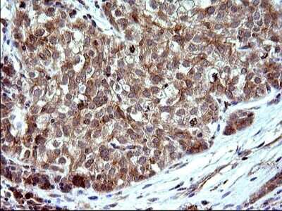 Immunohistochemistry: SHBG Antibody (OTI1H10) [NBP2-45825]