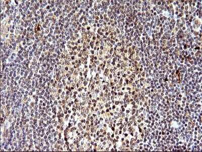 Immunohistochemistry: SHBG Antibody (OTI1H10) [NBP2-45825]