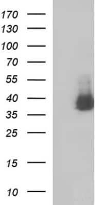 Western Blot: SHBG Antibody (OTI1H10) [NBP2-45825]