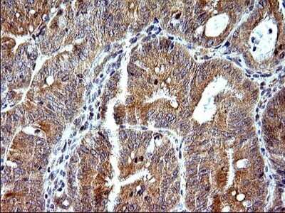 Immunohistochemistry: SHBG Antibody (OTI1H10) - Azide and BSA Free [NBP2-74166]