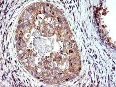 Immunohistochemistry: SHBG Antibody (OTI1H10) - Azide and BSA Free [NBP2-74166]