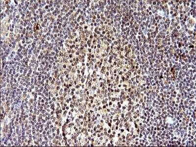 Immunohistochemistry: SHBG Antibody (OTI1H10) - Azide and BSA Free [NBP2-74166]
