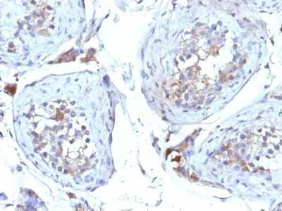 Immunohistochemistry-Paraffin: SHBG Antibody (SHBG/245) - Azide and BSA Free [NBP2-48007]