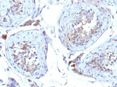 Immunohistochemistry-Paraffin: SHBG Antibody (SHBG/245) - IHC-Prediluted [NBP2-48425]