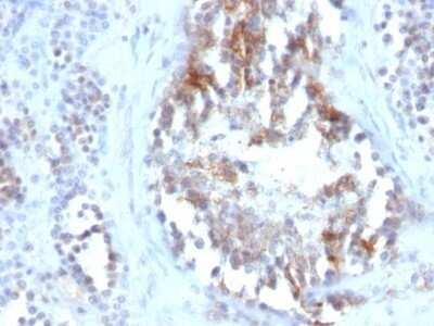 Immunohistochemistry-Paraffin: SHBG Antibody (SPM605) - IHC-Prediluted [NBP2-48426]