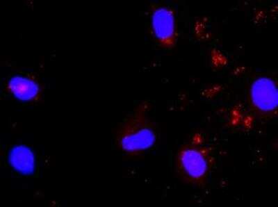 Proximity Ligation Assay: SHC1 Antibody (3F4) [H00006464-M01]