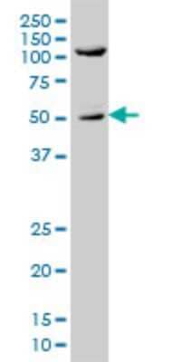 Western Blot: SHC1 Antibody (3F4) [H00006464-M01]