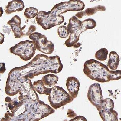 Immunohistochemistry: SHC1 Antibody [NBP1-87361]