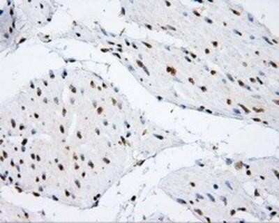 Immunohistochemistry-Paraffin: SHC1 Antibody (OTI3A1) [NBP2-02434]