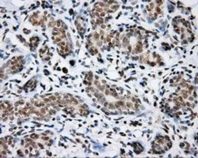 Immunohistochemistry-Paraffin: SHC1 Antibody (OTI3A1) [NBP2-02434]