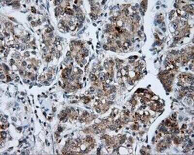 Immunohistochemistry-Paraffin: SHC1 Antibody (OTI3A1) [NBP2-02434]